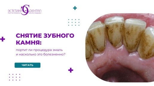 ������ ������� �����: ��� ����� ����� � ���������������� � ������������ ���������