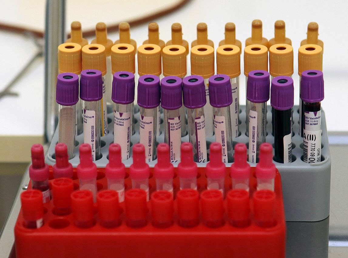 Массовую вспышку острой кишечной инфекции зафиксировали в Муроме