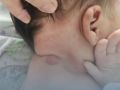 Врачи ОДКБ спасли новорождённого от редкой инфекции