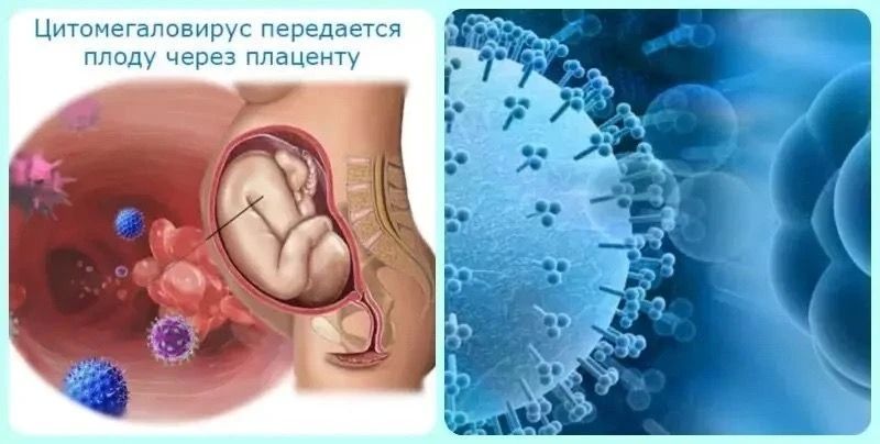 Врачи ОДКБ вернули малыша к полноценной жизни Врачи ОДКБ вернули малыша к полноценной жизни